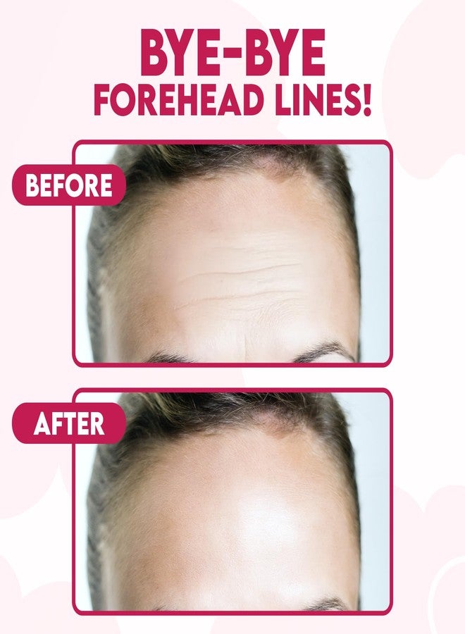 BLOOMORA Forehead Wrinkle Patches Overnight for Fine Lines & Hydration, Smoothing Facial Wrinkle Patches with Hyaluronic Acid, Peptides & Collagen, Hydrogel Anti Wrinkle Skincare for Men & Women (16pcs) - Image 2